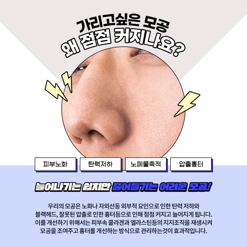 모공축소, 피코프락셀과 블랙헤드로 꼼꼼하게 관련 이미지 2