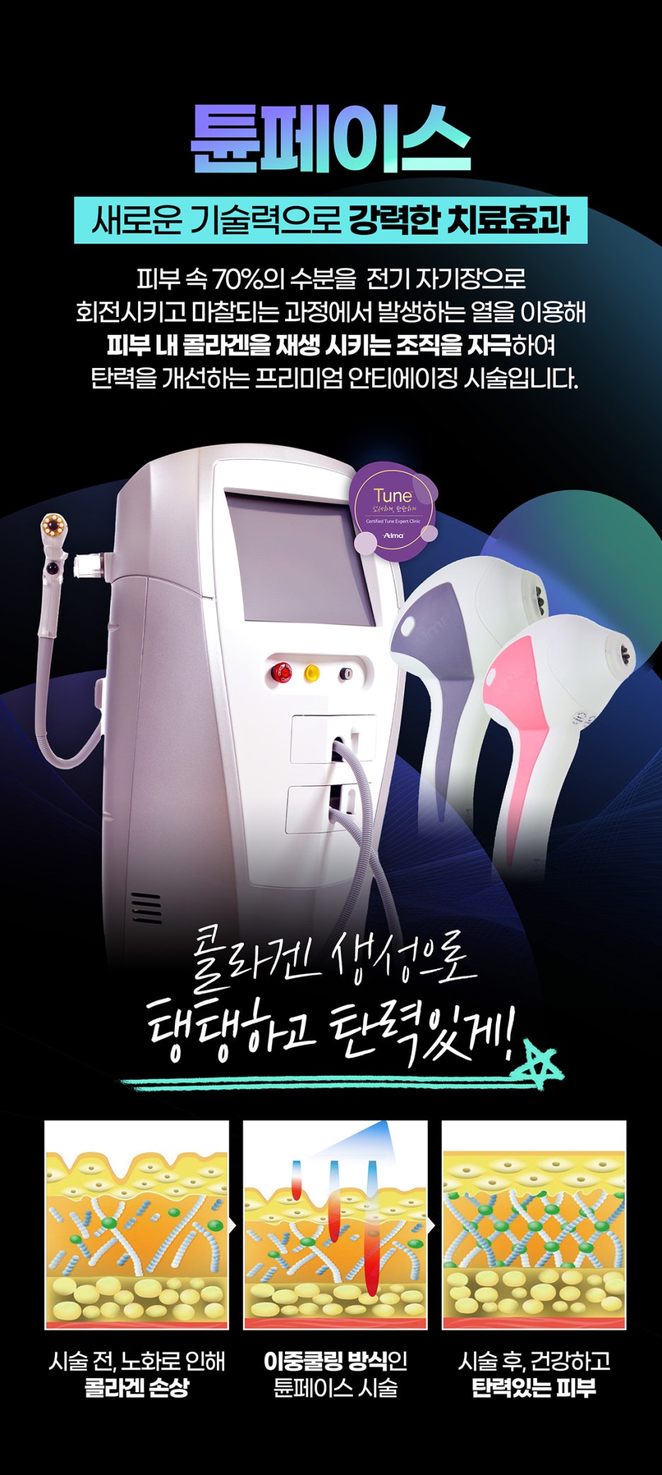 피부 처짐개선을 위한 비수술적 주름개선 시술 관련 이미지 7