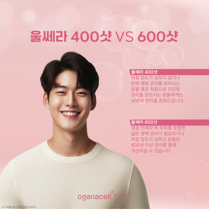 잠실울쎄라 400샷 vs 600샷, 내 피부에 적절한 샷수는? 관련 이미지 6