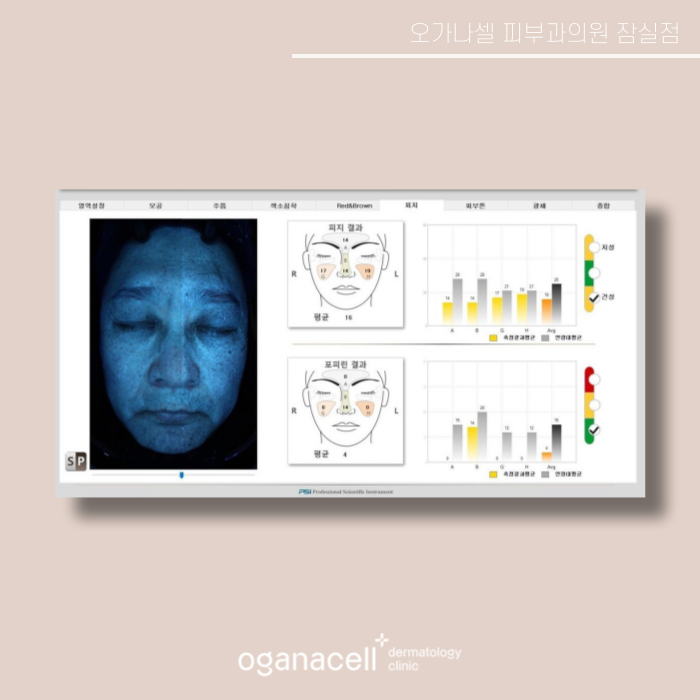 잠실새내 피부과 맞춤 피부교정 오가나셀잠실 관련 이미지 6