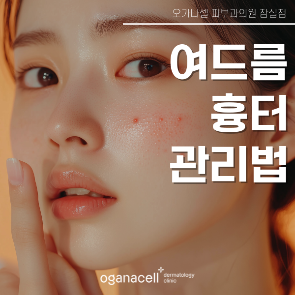 여드름 흉터 관리법 : 홈케어 및 잠실피부과 관리 관련 이미지 1