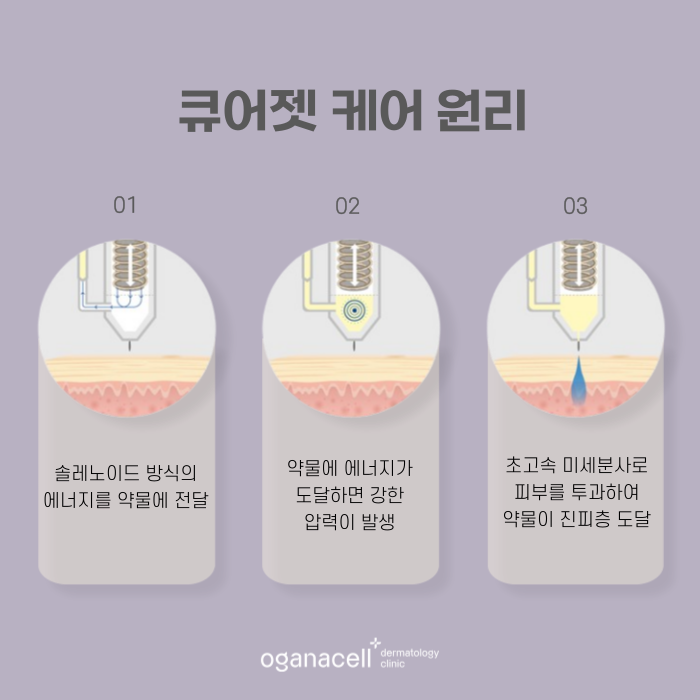잠실 큐어젯 있는 피부과 관련 이미지 5