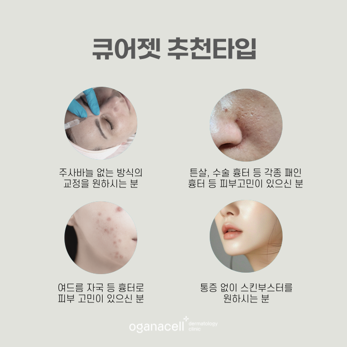 잠실피부과 큐어젯 하는 곳 관련 이미지 3
