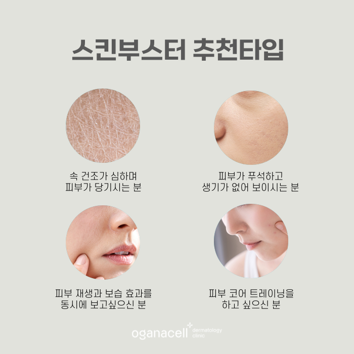 잠실역피부과 고민해결에 좋은 스킨부스터 관련 이미지 3