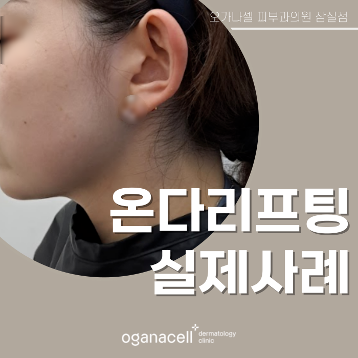 잠실 온다리프팅 관리 전후 비교 실제사례 관련 이미지 1