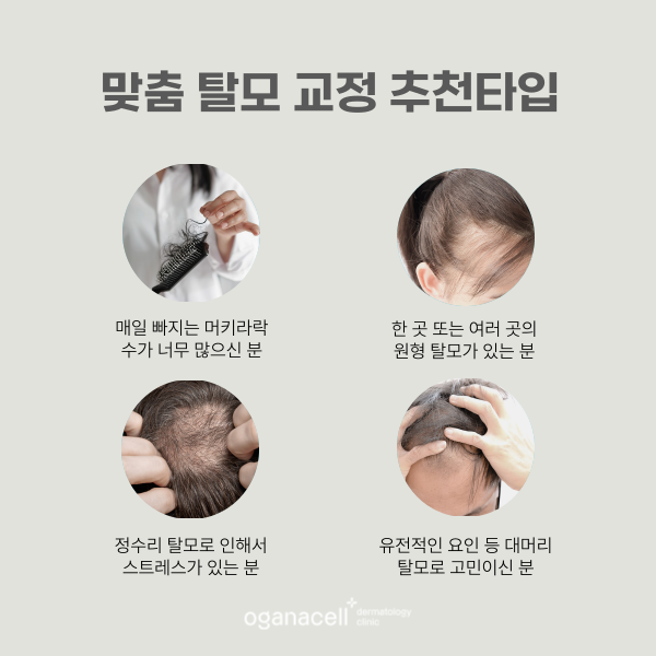 머리카락 빠지는 원인 잡고 탈모교정하는법 관련 이미지 3