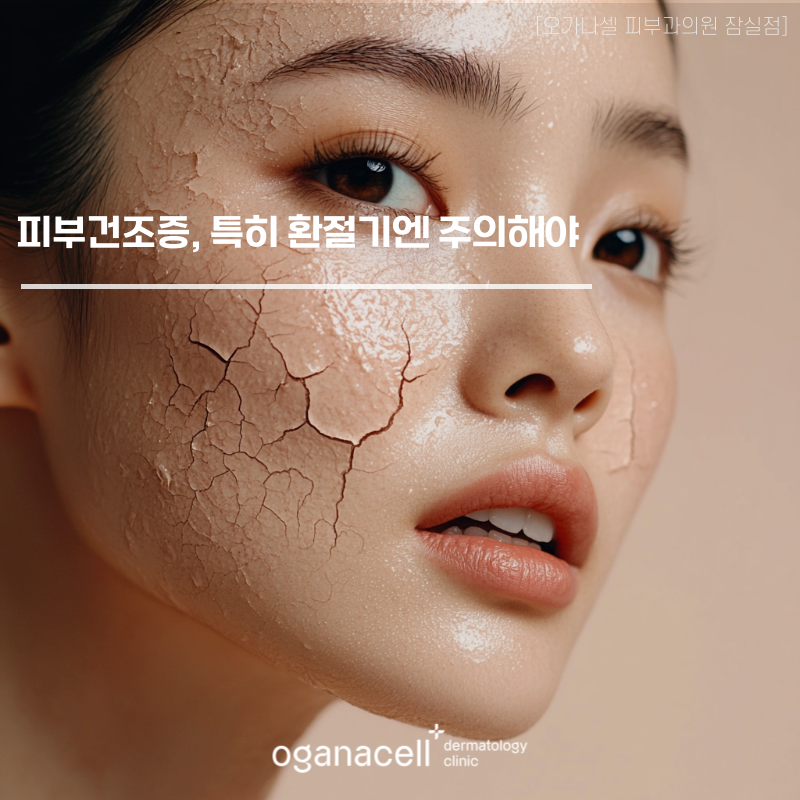 피부건조증, 특히 환절기에 주의해야 하는 이유 관련 이미지 1