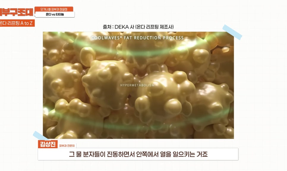 잠실 온다 티타늄 리프팅 피부과, 즉각적인 효과를 주는 건? 관련 이미지 2