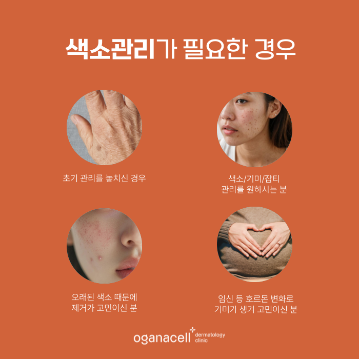 40대피부관리 색소 초기 관리의 중요성 관련 이미지 3