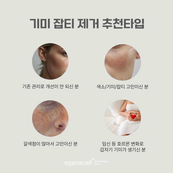 얼굴 갈색점 알고보면 기미일 수 있어요 관련 이미지 3