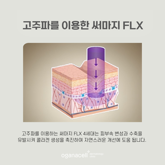 잠실 써마지 4세대가 좋은 이유 관련 이미지 5