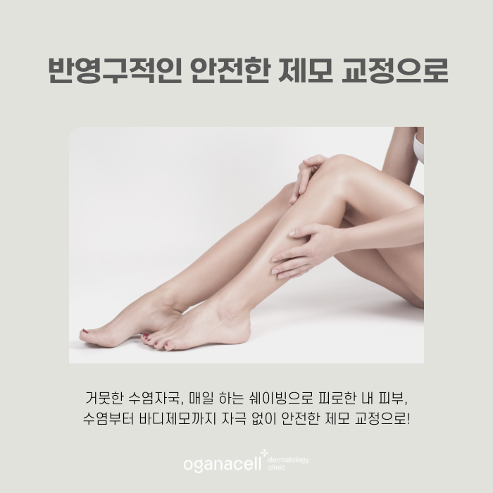 반영구제모 안전하게 할 수 있는 잠실피부과 관련 이미지 6