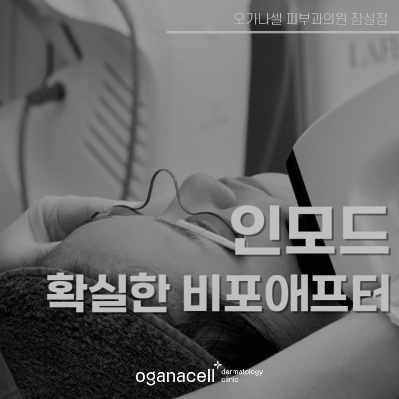 인모드 장점 및 주의할 점 5가지 관련 이미지 1