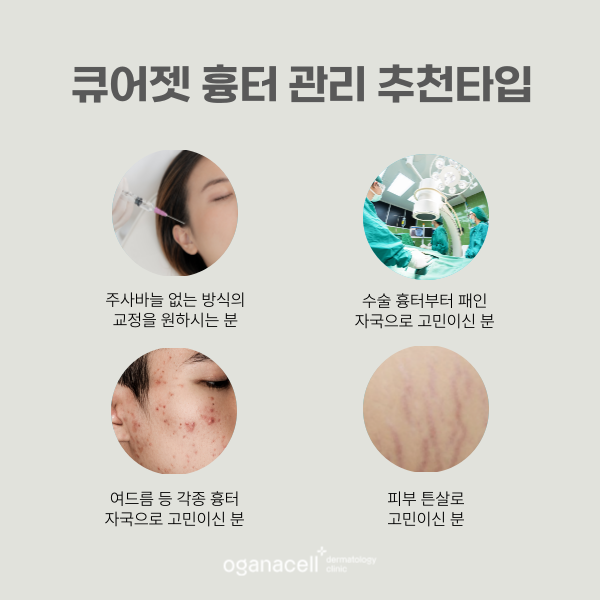 롯데월드타워피부과 흉터 관리 잘하는 곳 관련 이미지 4