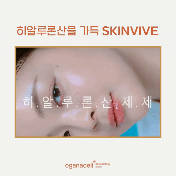 얼굴 잔주름 개선 방법 잠실 스킨바이브 관련 이미지 7