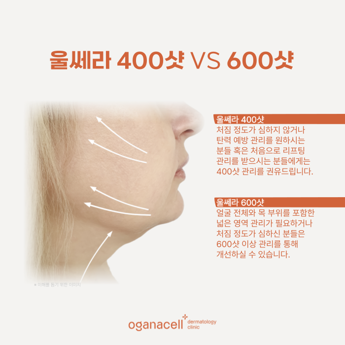 잠실피부과울쎄라 400샷 VS 600샷 고민될 때 관련 이미지 6