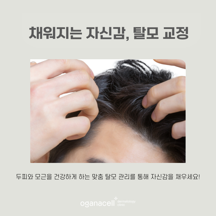 M자부터 정수리까지 자신감을 채워주는 잠실피부과 관련 이미지 7