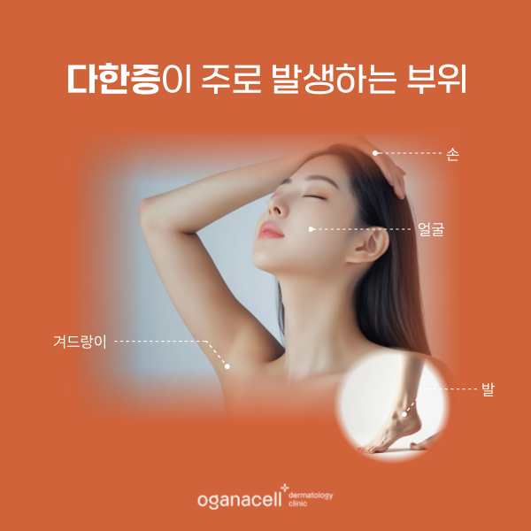 다한증 & 액취증 잠실피부과 관리 방법은? 관련 이미지 4