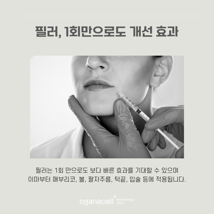 잠실필러 자연스러운 입체감과 균형감까지 관련 이미지 5