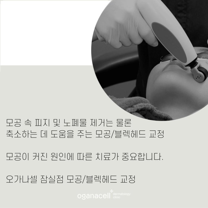 모공 줄이는 법, 커지는 원인부터 알아야 합니다 관련 이미지 11