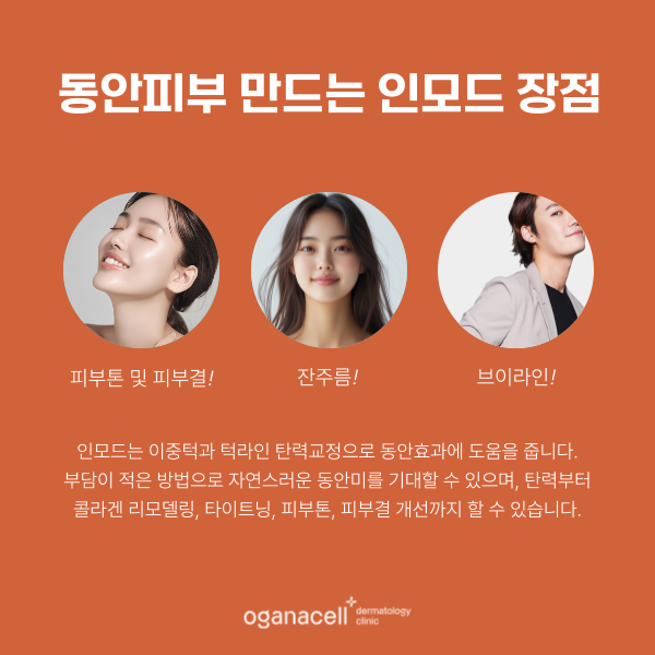 잠실 인모드 유지기간 및 좋은점 관련 이미지 5