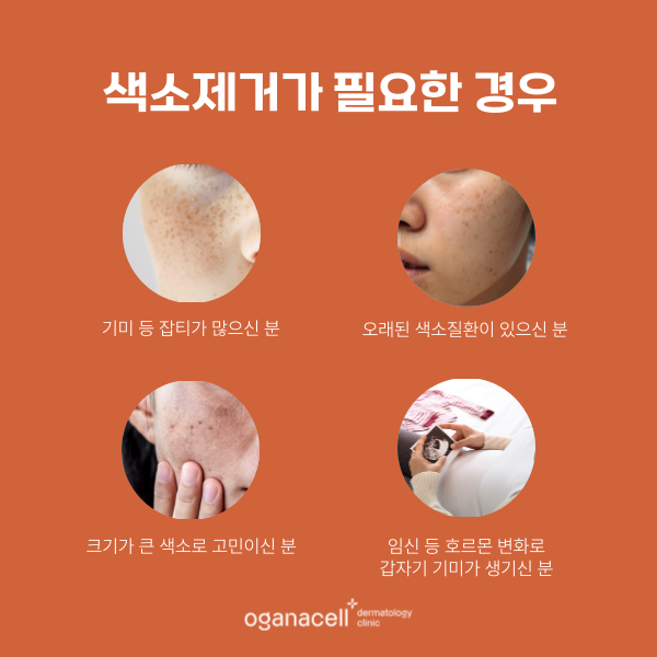 기미 색소 제거 잘하는 잠실 피부과 관련 이미지 3