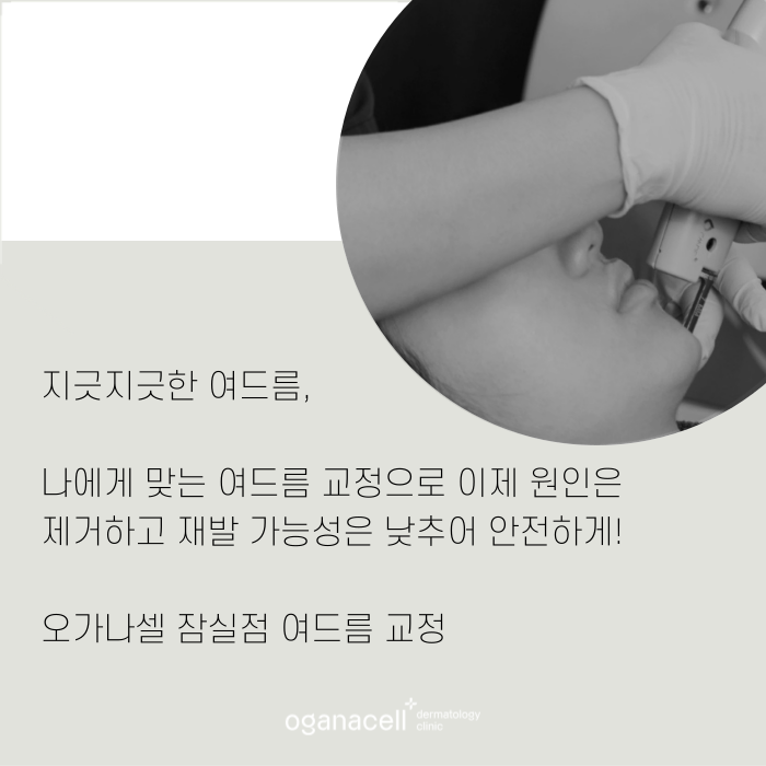 여드름제거 방법 원인부터 없애는 게 좋아요 관련 이미지 11