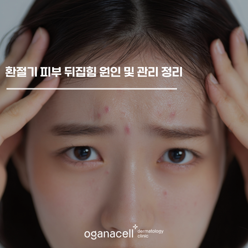 잠실피부과전문의 가 알려주는 환절기 피부 뒤집힘 원인 및 관리 정리 관련 이미지 1