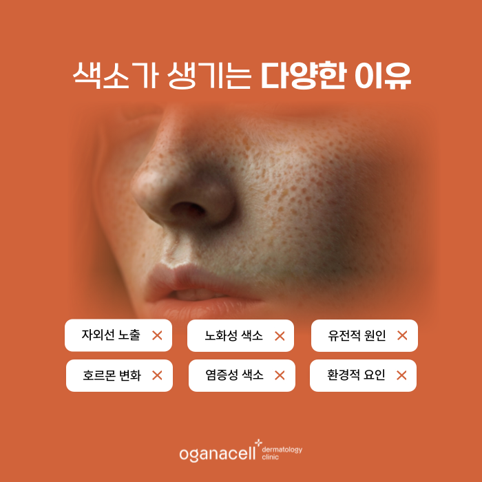 40대피부관리 색소 초기 관리의 중요성 관련 이미지 4