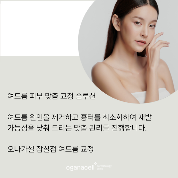 잠실여드름피부과 재발 가능성 낮추는 팁 관련 이미지 8