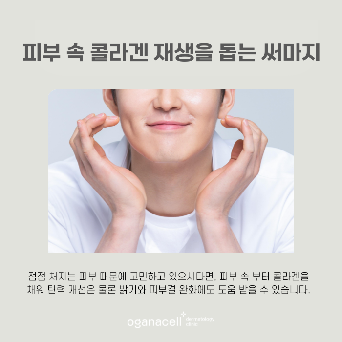 잠실 써마지 4세대가 좋은 이유 관련 이미지 4