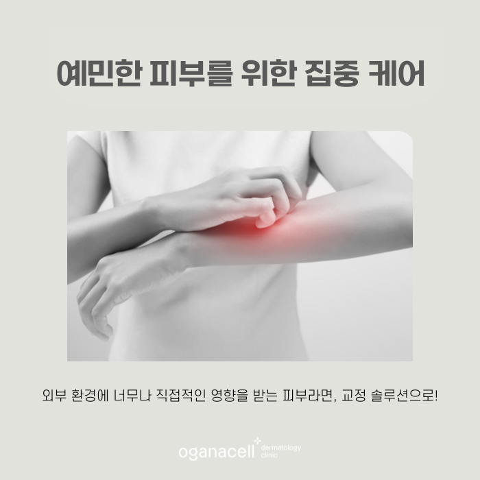 예민한피부 뒤집어지는 주요 원인 관련 이미지 7