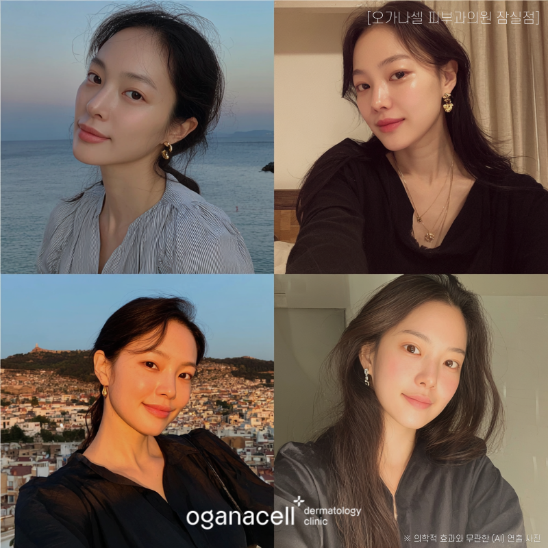 잠실 줄기세포 피부과 관리 3가지 관련 이미지 6
