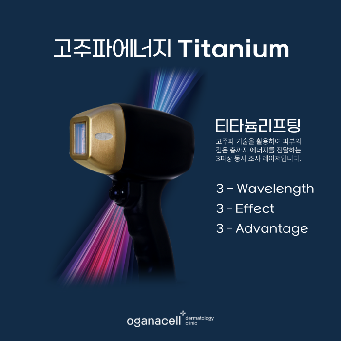 티타늄리프팅 기대효과 - 잠실피부과 오가나셀 관련 이미지 4