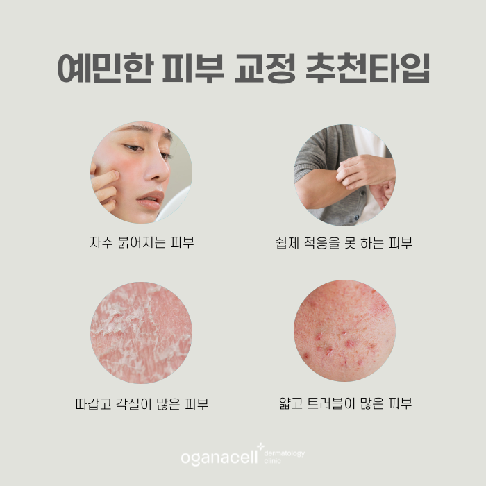 예민한피부 뒤집어지는 주요 원인 관련 이미지 5
