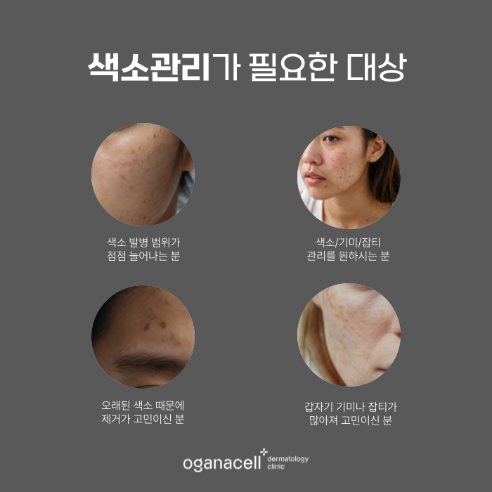 잠실역 피부과 - 기미, 색소침착 원인부터 예방 방법 관련 이미지 3