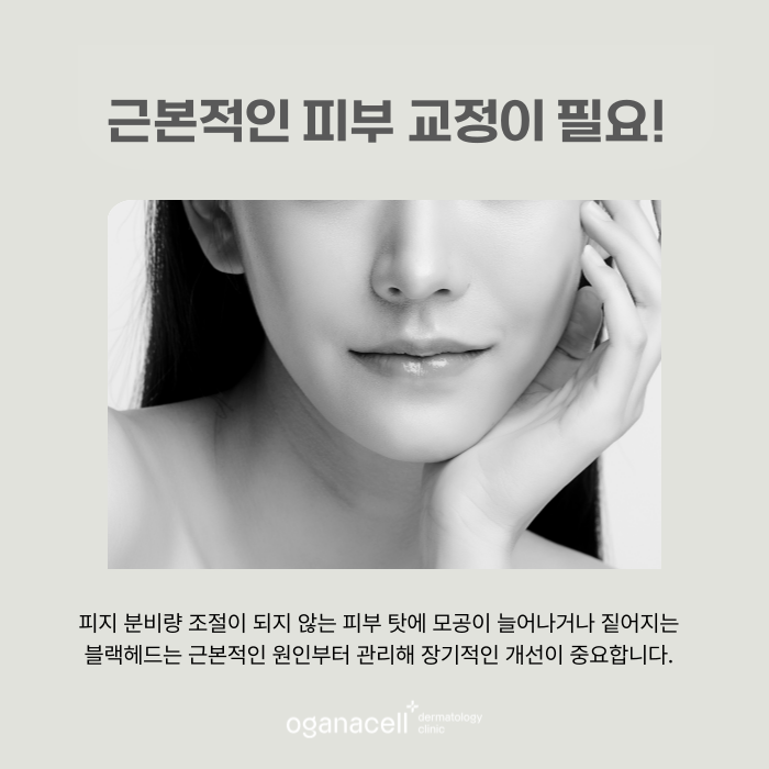 코의피지 제거하는 방법 원인부터 개선해야 관련 이미지 5