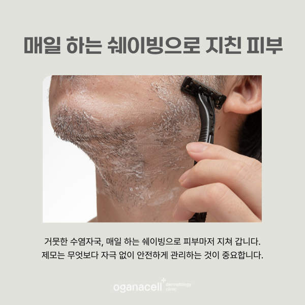 남자수염제모 깨끗하게 잘하는 잠실피부과 관련 이미지 5