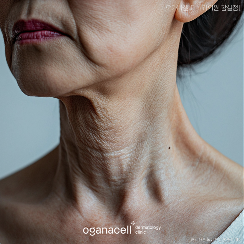 가로 세로 목주름 생기는 원인 등 알아볼게요 관련 이미지 4