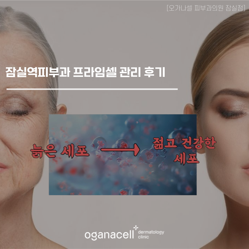 잠실역피부과 프라임셀 관리 후기 관련 이미지 1