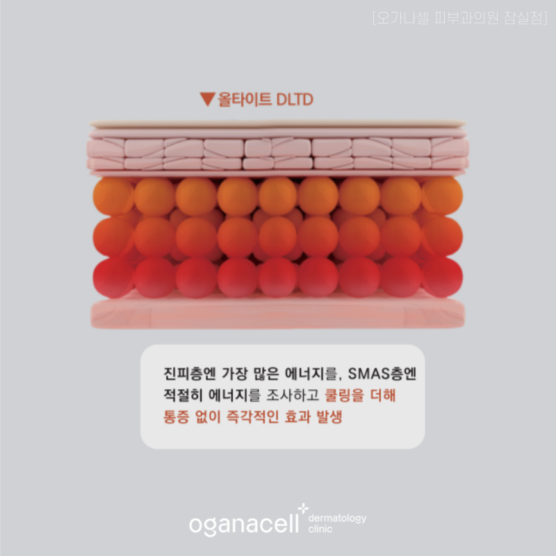 잠실올타이트리프팅 주기 유지기간 등 알아보기 관련 이미지 3