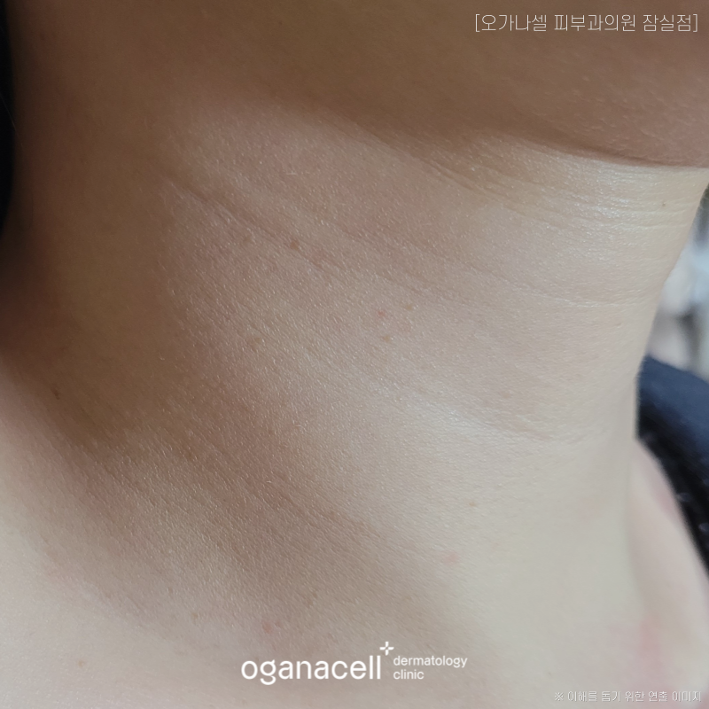 피부가 처지는 원인, 관리해도 늙는 피부 어떻게? 관련 이미지 5