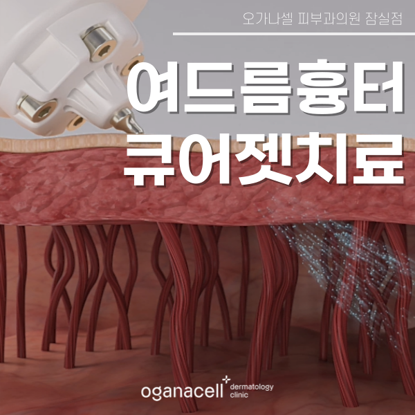 잠실 여드름흉터 제거하는 방법 관련 이미지 1