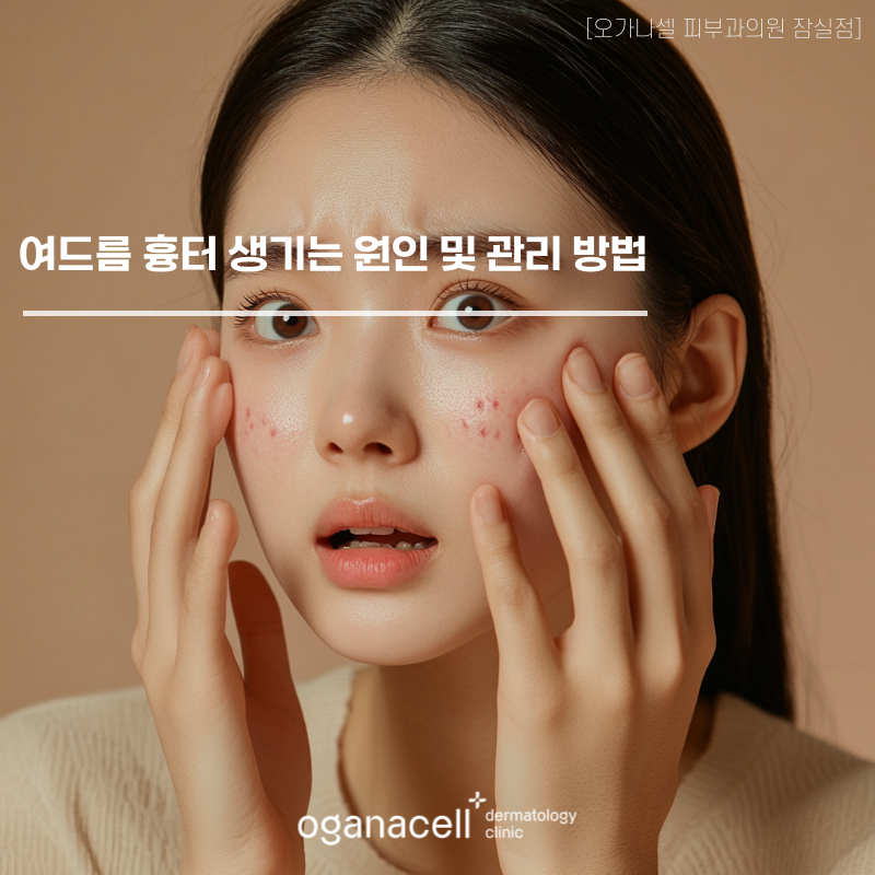 여드름 흉터 생기는 원인 및 관리 방법 관련 이미지 1