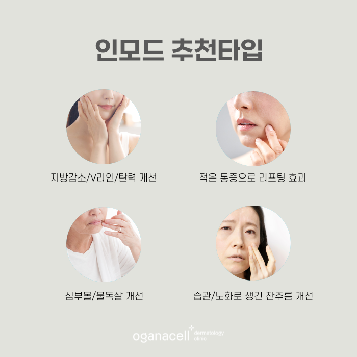 잠실인모드 유지기간 및 주의점 관련 이미지 3