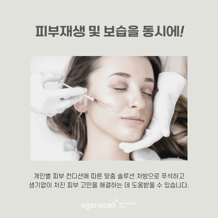 잠실 리쥬란 잘하는 곳 관련 이미지 6