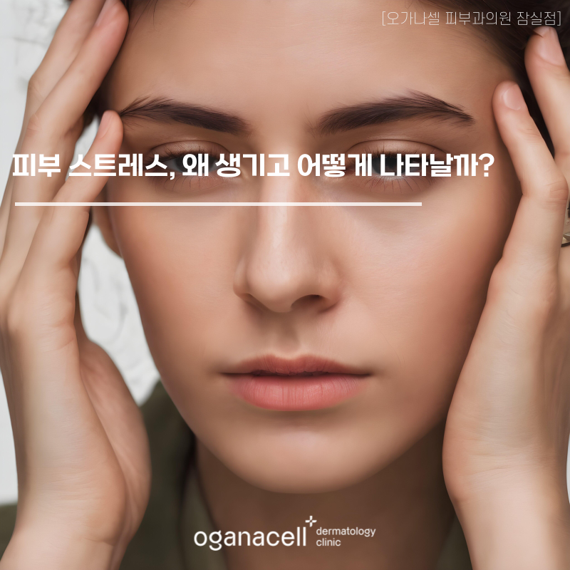 피부 스트레스, 왜 생기고 어떻게 나타날까? 관련 이미지 1