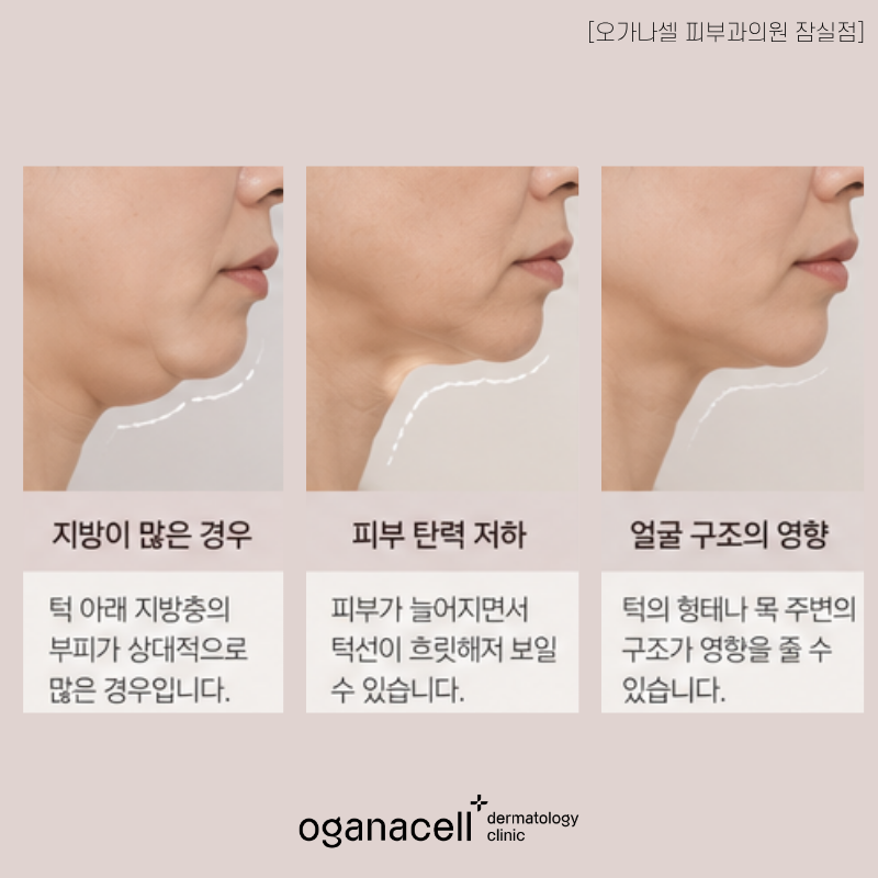 잠실 송파 올타이트, 모두에게 답은 아닙니다 관련 이미지 3