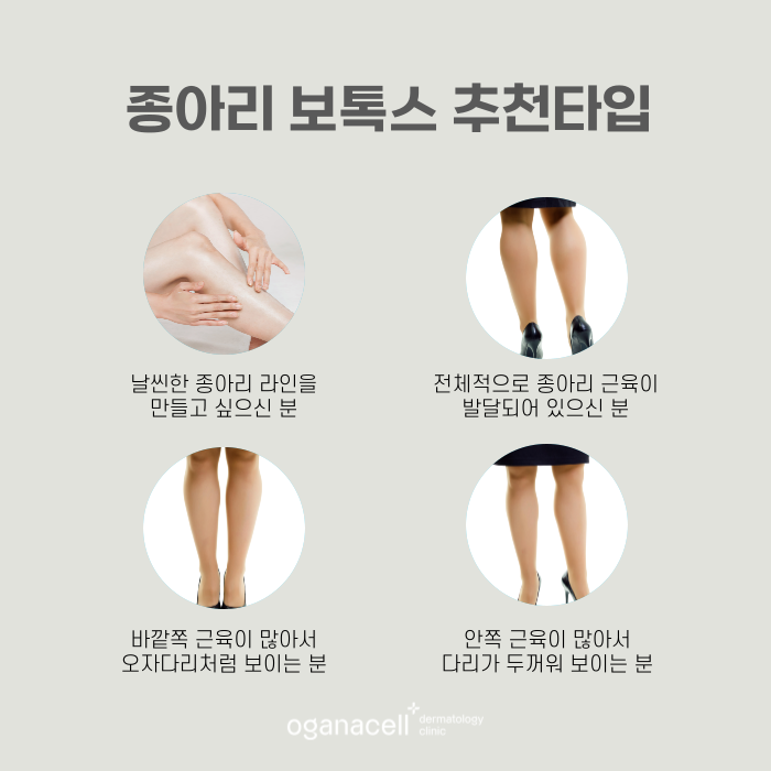 다리 종아리 라인 예뻐지는 방법 관련 이미지 3