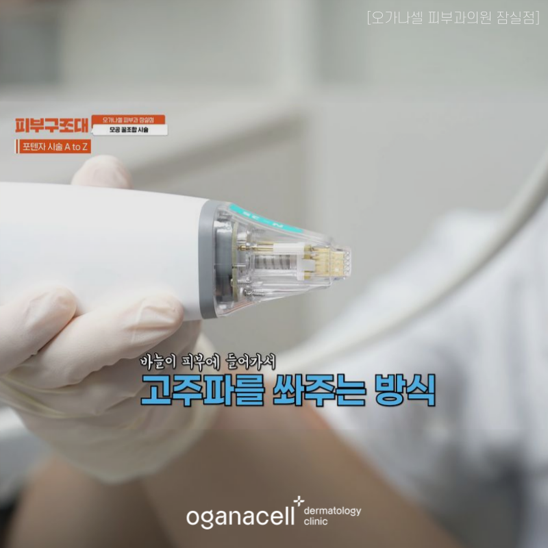잠실 포텐자 피부과 모공관리 방법 관련 이미지 3